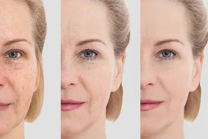 Masajeador Facial Reductor Recargable