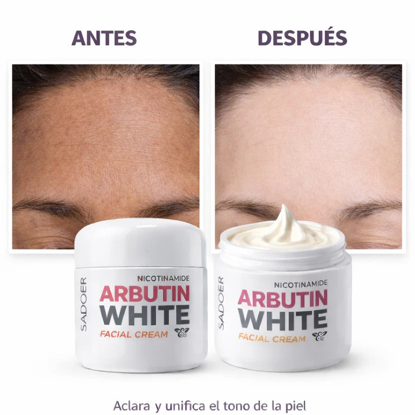 Arbutin White® - Crema Aclarante Facial
